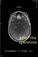 Gray, Elizabeth T.: After the Operation