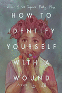 KB: How to Identify Yourself with a Wound